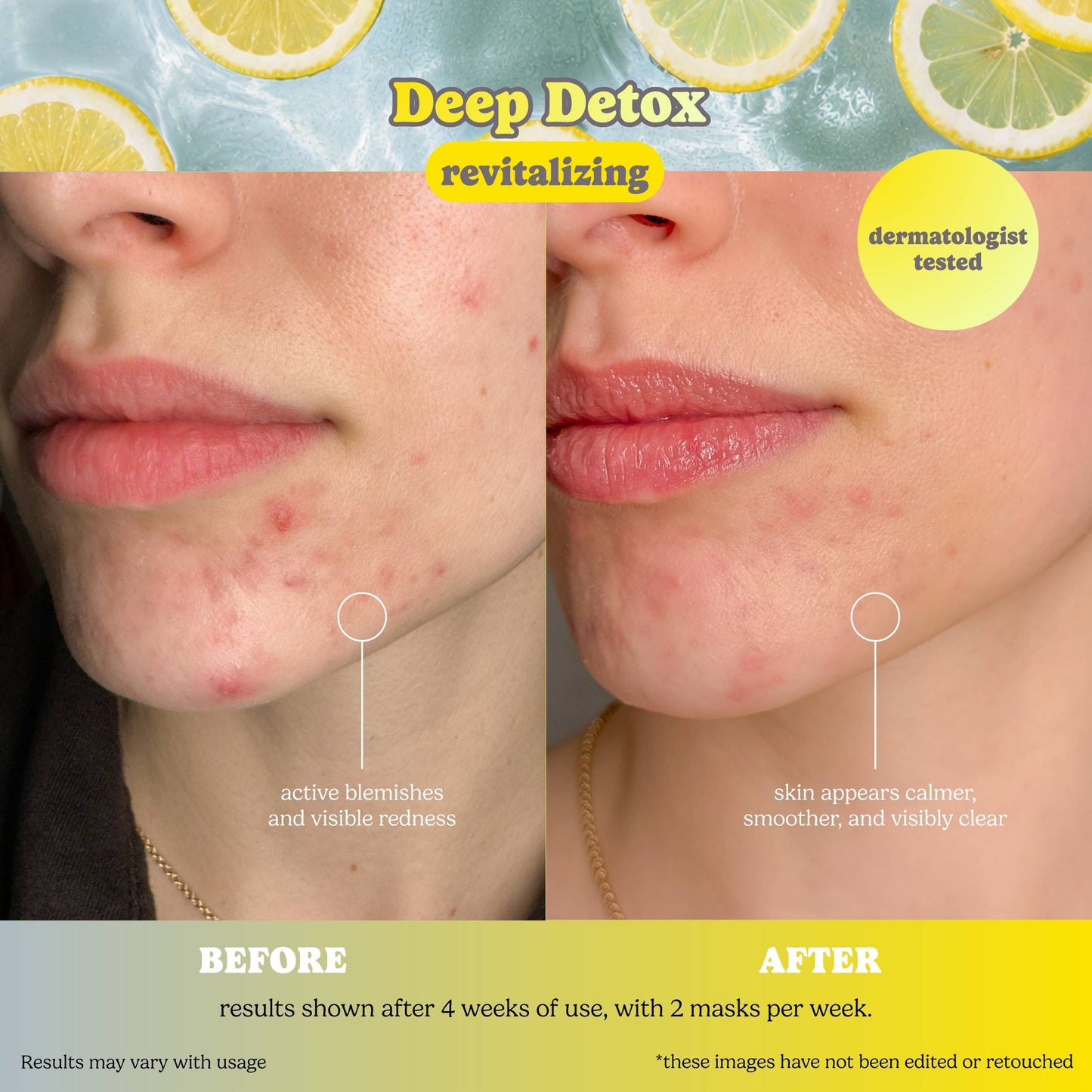 Deep Detox Sheet Mask