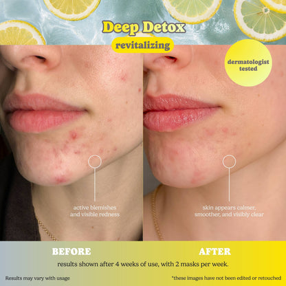 Deep Detox Sheet Mask